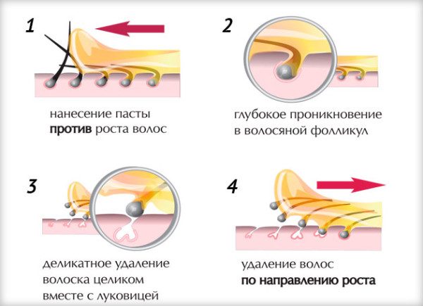 Схема удаления волос сахарной пастой